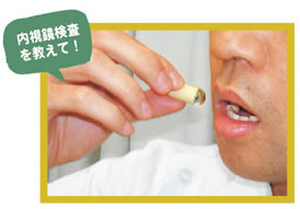 内視鏡