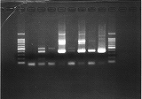 ウイルス遺伝子のゲル泳動写真